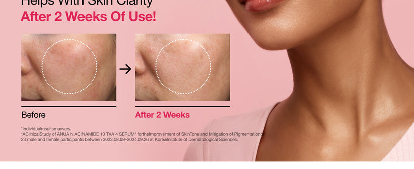 Anua, Niacinamide 10% + TXA 4% Dark Spot Correcting Serum