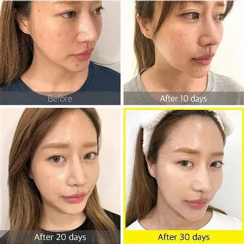 Some By Mi - Yuja Niacin 30 Days Brightening Starter Kit 4 Pcs