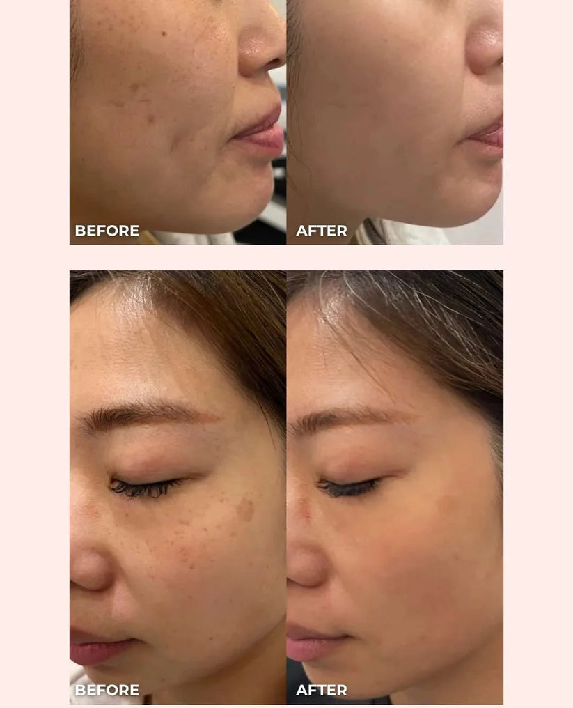 Some By Mi - Yuja Niacin 30 Days Brightening Starter Kit 4 Pcs